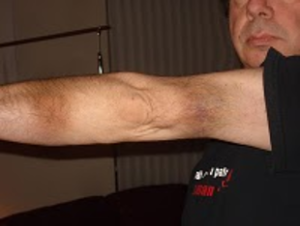 Picture6